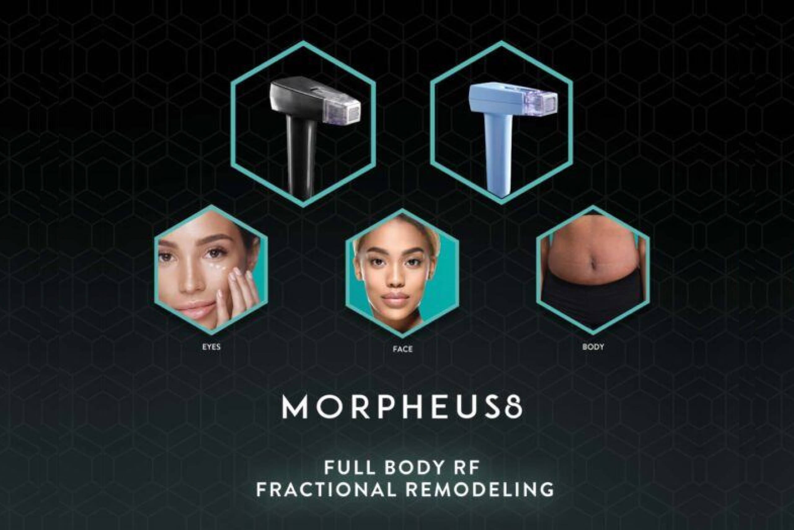 Morpheus8 Treatment Guildford Dentist