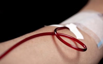 Intravenous (IV) Iron Treatment in London and Surrey: Fast Relief for Iron and Ferritin Deficiency