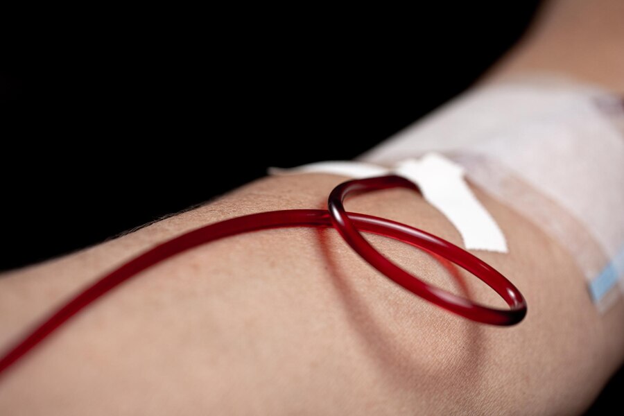 Intravenous (IV) Iron Treatment in London and Surrey: Fast Relief for Iron and Ferritin Deficiency