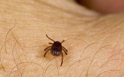 Tick-Borne Diseases: Symptoms, Testing & Treatment in London