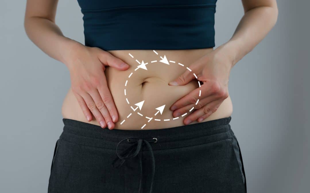 VASER Liposuction in London: A Full Breakdown of Treatable Areas & Pricing Packages
